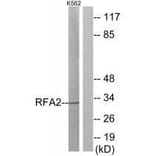 Western blot - RFA2 (Ab-21) Antibody from Signalway Antibody (33162) - Antibodies.com