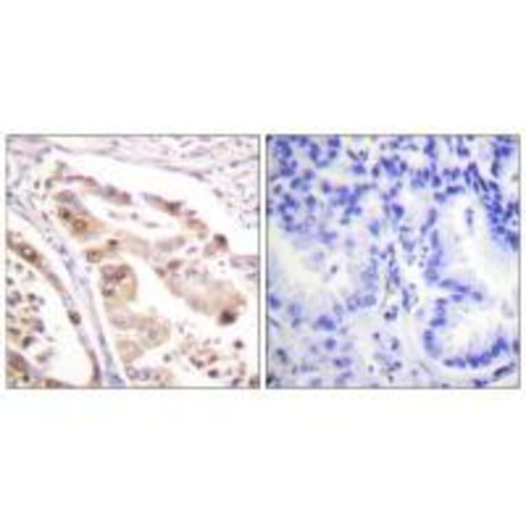 Immunohistochemistry - RFA2 (Ab-21) Antibody from Signalway Antibody (33162) - Antibodies.com