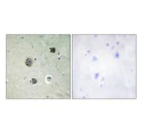 Immunohistochemistry - CDK5 (Ab-15) Antibody from Signalway Antibody (33178) - Antibodies.com