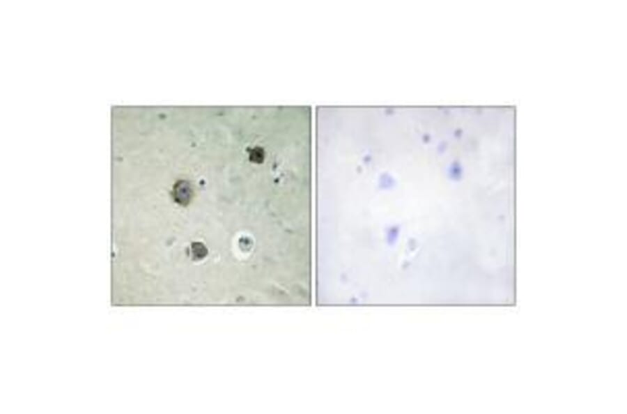 Immunohistochemistry - CDK5 (Ab-15) Antibody from Signalway Antibody (33178) - Antibodies.com