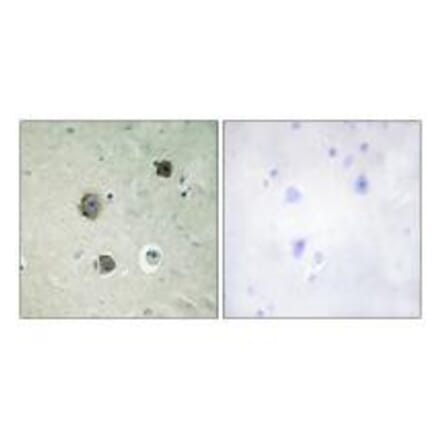 Immunohistochemistry - CDK5 (Ab-15) Antibody from Signalway Antibody (33178) - Antibodies.com