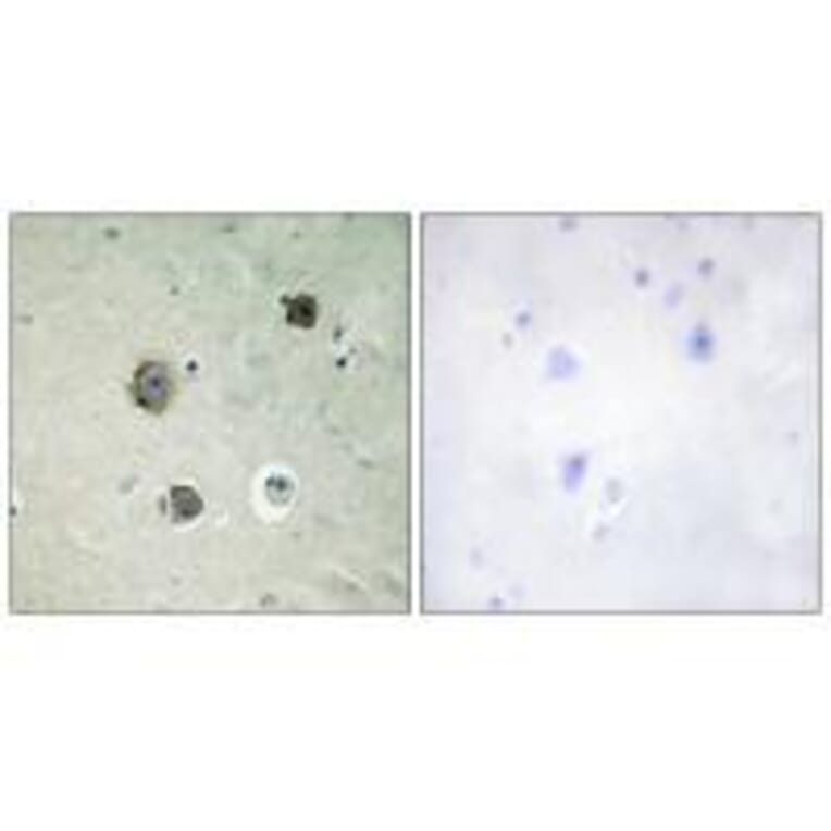 Immunohistochemistry - CDK5 (Ab-15) Antibody from Signalway Antibody (33178) - Antibodies.com