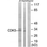 Western blot - CDK5 (Ab-15) Antibody from Signalway Antibody (33178) - Antibodies.com