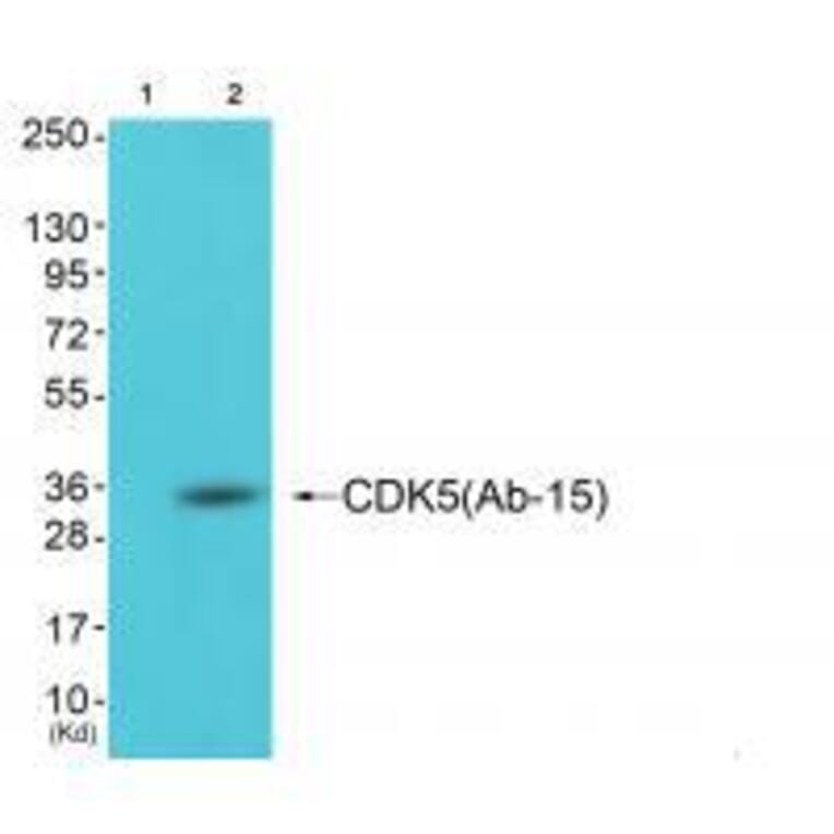 Western blot - CDK5 (Ab-15) Antibody from Signalway Antibody (33178) - Antibodies.com