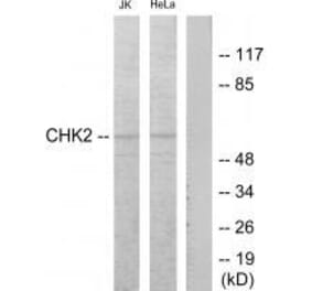 Western blot - Chk2 (Ab-68) Antibody from Signalway Antibody (33186) - Antibodies.com