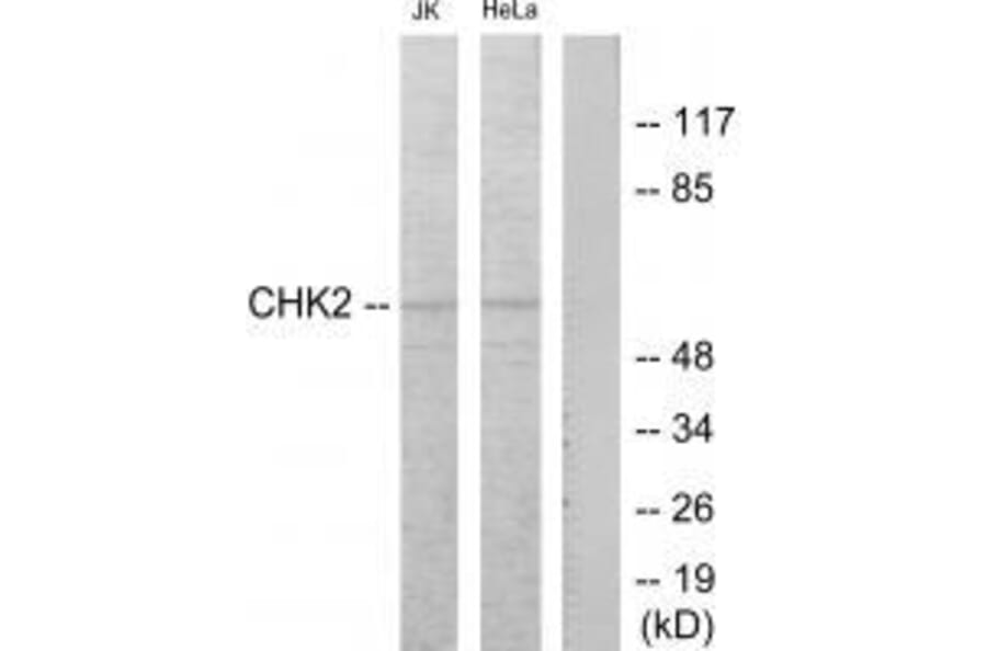 Western blot - Chk2 (Ab-68) Antibody from Signalway Antibody (33186) - Antibodies.com