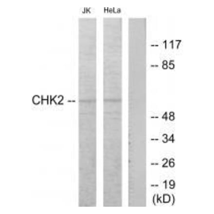 Western blot - Chk2 (Ab-68) Antibody from Signalway Antibody (33186) - Antibodies.com