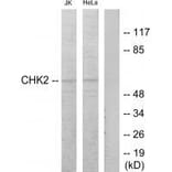 Western blot - Chk2 (Ab-68) Antibody from Signalway Antibody (33186) - Antibodies.com