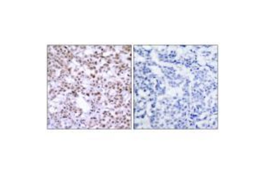 Immunohistochemistry - Chk2 (Ab-68) Antibody from Signalway Antibody (33186) - Antibodies.com
