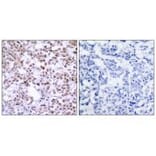 Immunohistochemistry - Chk2 (Ab-68) Antibody from Signalway Antibody (33186) - Antibodies.com