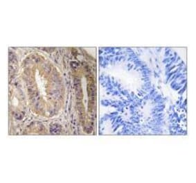 Immunohistochemistry - FAK (Ab-843) Antibody from Signalway Antibody (33214) - Antibodies.com