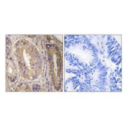 Immunohistochemistry - FAK (Ab-843) Antibody from Signalway Antibody (33214) - Antibodies.com