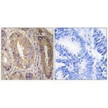 Immunohistochemistry - FAK (Ab-843) Antibody from Signalway Antibody (33214) - Antibodies.com