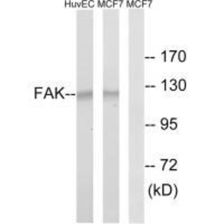 Western blot - FAK (Ab-843) Antibody from Signalway Antibody (33214) - Antibodies.com