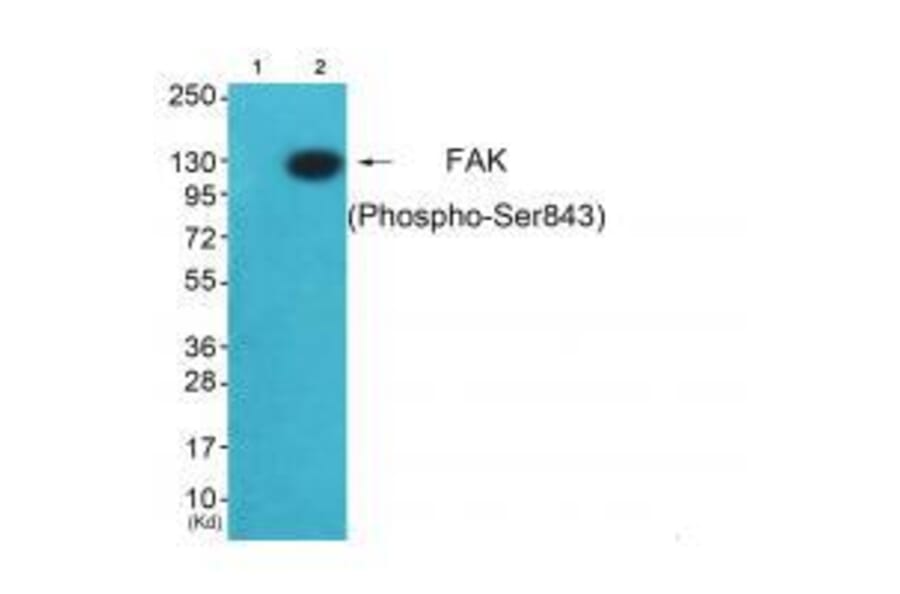 Western blot - FAK (Ab-843) Antibody from Signalway Antibody (33214) - Antibodies.com