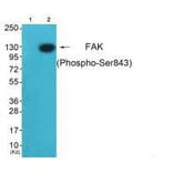 Western blot - FAK (Ab-843) Antibody from Signalway Antibody (33214) - Antibodies.com
