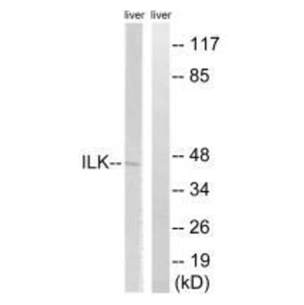 Western blot - ILK (Ab-246) Antibody from Signalway Antibody (33229) - Antibodies.com