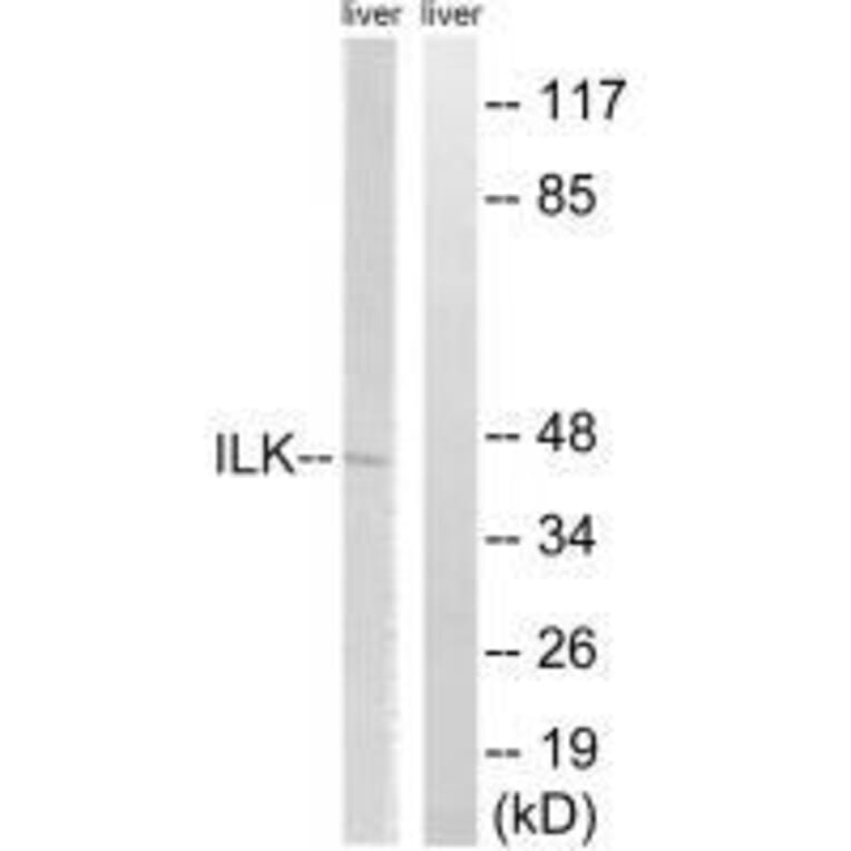 Western blot - ILK (Ab-246) Antibody from Signalway Antibody (33229) - Antibodies.com