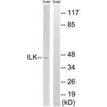 Western blot - ILK (Ab-246) Antibody from Signalway Antibody (33229) - Antibodies.com
