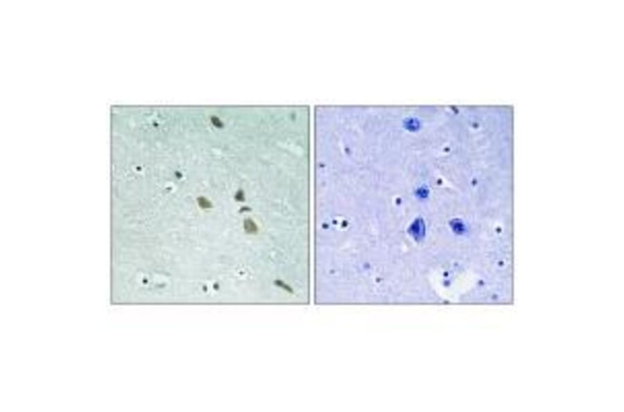 Immunohistochemistry - ILK (Ab-246) Antibody from Signalway Antibody (33229) - Antibodies.com