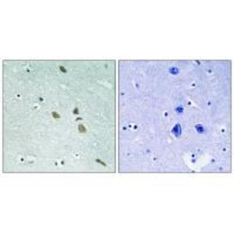 Immunohistochemistry - ILK (Ab-246) Antibody from Signalway Antibody (33229) - Antibodies.com