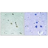 Immunohistochemistry - ILK (Ab-246) Antibody from Signalway Antibody (33229) - Antibodies.com