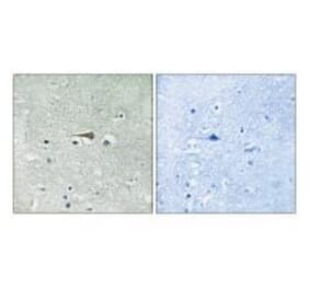 Immunohistochemistry - TTK (Ab-676) Antibody from Signalway Antibody (33252) - Antibodies.com