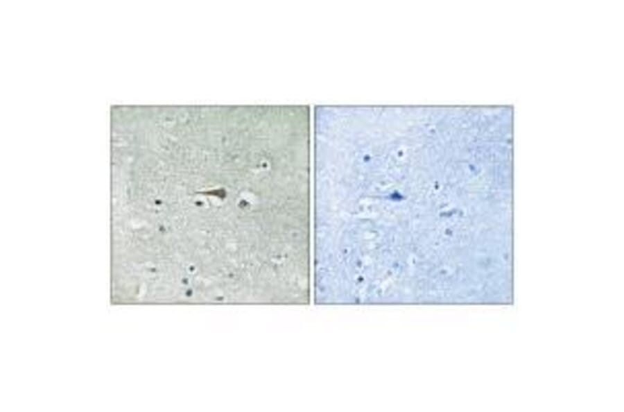 Immunohistochemistry - TTK (Ab-676) Antibody from Signalway Antibody (33252) - Antibodies.com