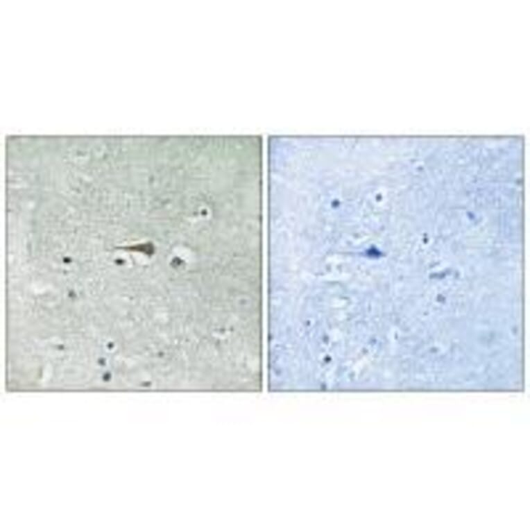 Immunohistochemistry - TTK (Ab-676) Antibody from Signalway Antibody (33252) - Antibodies.com