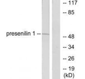 Western blot - Presenilin 1 Antibody from Signalway Antibody (33474) - Antibodies.com