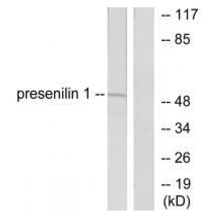Western blot - Presenilin 1 Antibody from Signalway Antibody (33474) - Antibodies.com