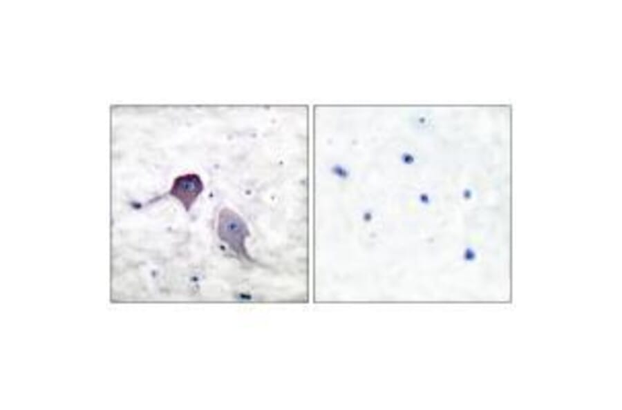 Immunohistochemistry - Presenilin 1 Antibody from Signalway Antibody (33474) - Antibodies.com