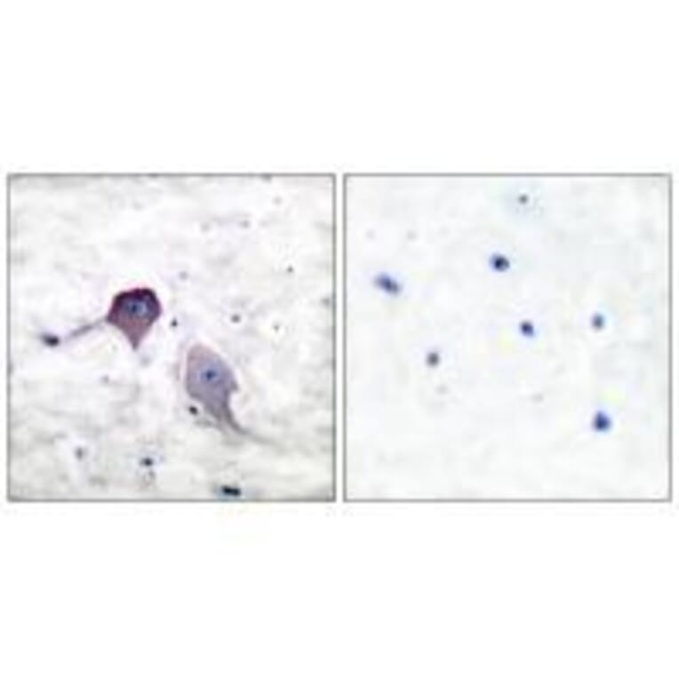 Immunohistochemistry - Presenilin 1 Antibody from Signalway Antibody (33474) - Antibodies.com