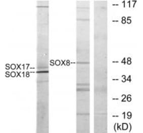 Western blot - SOX8/9/17/18 Antibody from Signalway Antibody (33827) - Antibodies.com