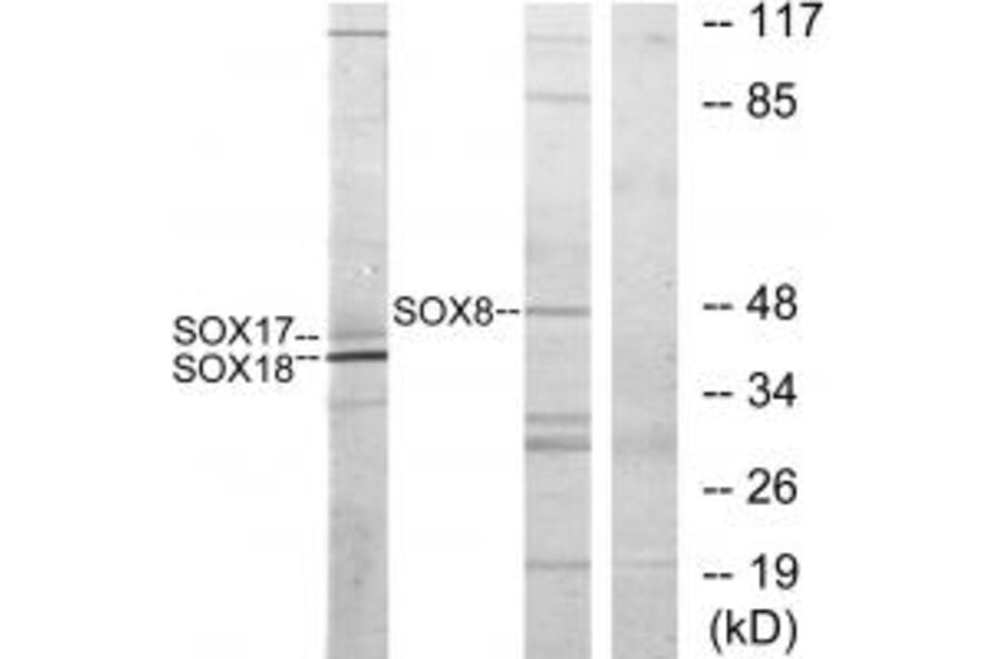 Western blot - SOX8/9/17/18 Antibody from Signalway Antibody (33827) - Antibodies.com