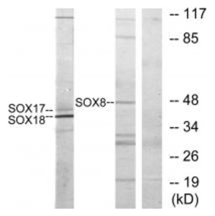 Western blot - SOX8/9/17/18 Antibody from Signalway Antibody (33827) - Antibodies.com
