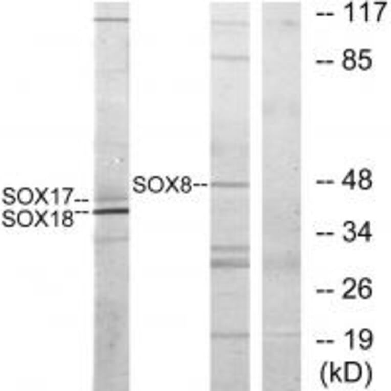Western blot - SOX8/9/17/18 Antibody from Signalway Antibody (33827) - Antibodies.com