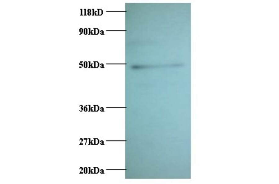 C-C motif chemokine 2 Polyclonal Antibody from Signalway Antibody (42442) - Antibodies.com