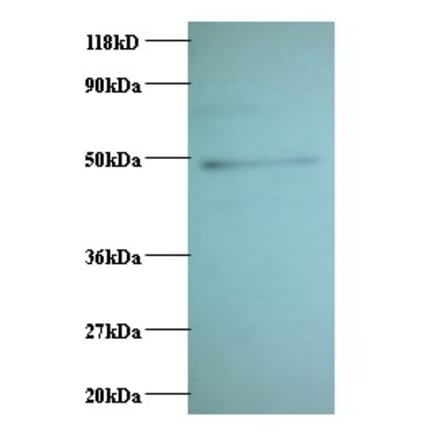 C-C motif chemokine 2 Polyclonal Antibody from Signalway Antibody (42442) - Antibodies.com