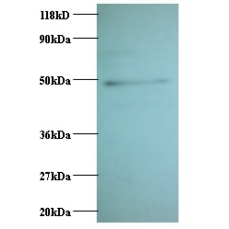 C-C motif chemokine 2 Polyclonal Antibody from Signalway Antibody (42442) - Antibodies.com