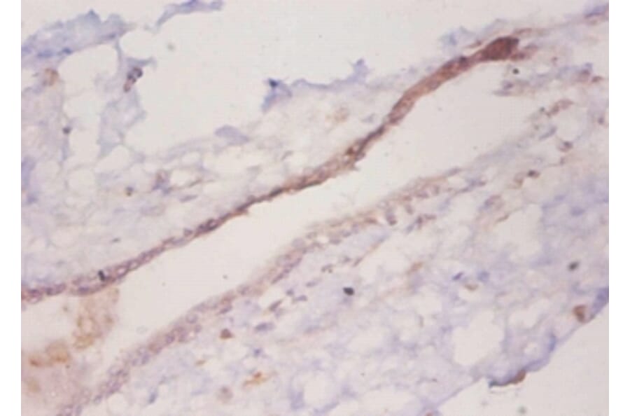 Immunohistochemistry - C-C motif chemokine 2 Polyclonal Antibody from Signalway Antibody (42442) - Antibodies.com
