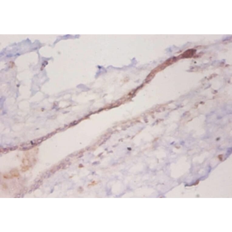 Immunohistochemistry - C-C motif chemokine 2 Polyclonal Antibody from Signalway Antibody (42442) - Antibodies.com