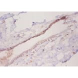 Immunohistochemistry - C-C motif chemokine 2 Polyclonal Antibody from Signalway Antibody (42442) - Antibodies.com