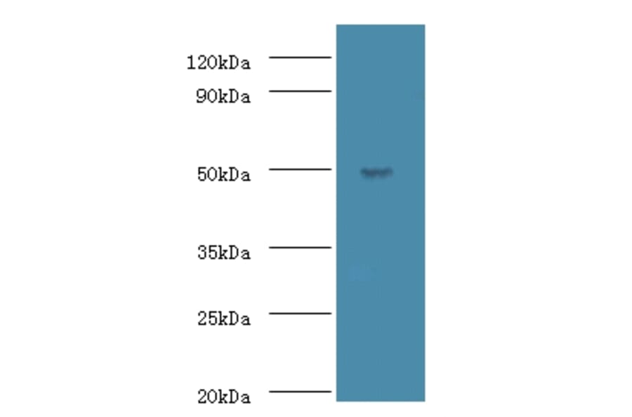 Actin-like protein 7A Polyclonal Antibody from Signalway Antibody (42698) - Antibodies.com
