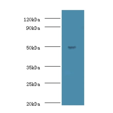 Actin-like protein 7A Polyclonal Antibody from Signalway Antibody (42698) - Antibodies.com