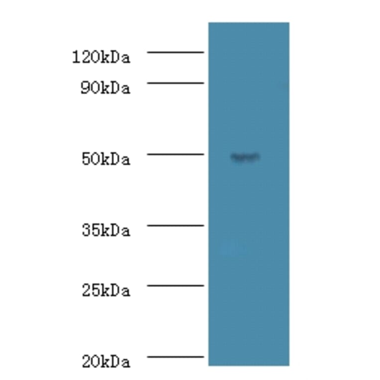 Actin-like protein 7A Polyclonal Antibody from Signalway Antibody (42698) - Antibodies.com
