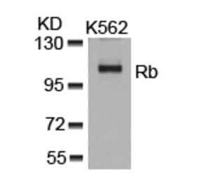 Western blot - Rb (Ab-807) Antibody from Signalway Antibody (21109) - Antibodies.com
