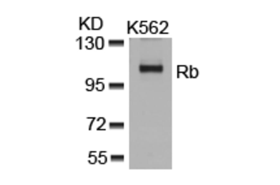 Western blot - Rb (Ab-807) Antibody from Signalway Antibody (21109) - Antibodies.com