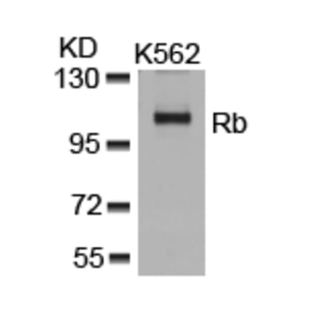 Western blot - Rb (Ab-807) Antibody from Signalway Antibody (21109) - Antibodies.com