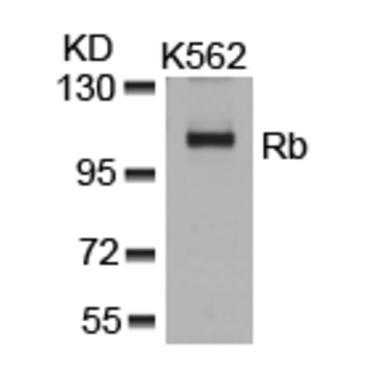 Western blot - Rb (Ab-807) Antibody from Signalway Antibody (21109) - Antibodies.com